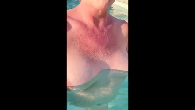 Man swimming naked in pool with red chest rash and water droplets