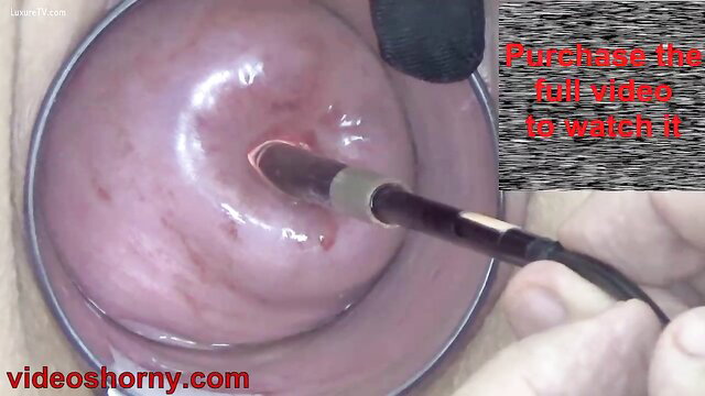 Endoscope camera inserted into cervix close-up pussy exam video