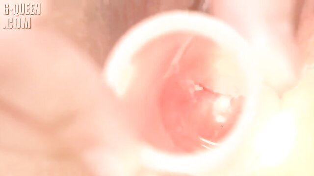 Sayaka Kano Gqueen closeup pussy speculum exam spread wide