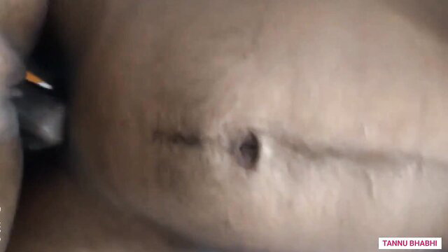 Tannu Bhabhi closeup pussy with stitches after kinky hotel fuck