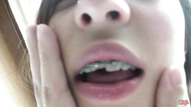 Carolina Abril closeup mouth open with braces, sexy face