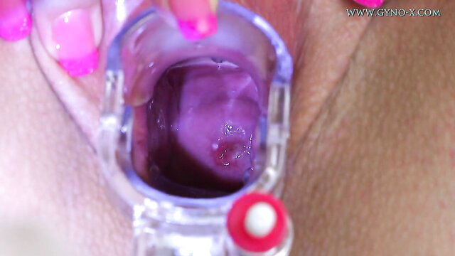 Closeup pussy exam with speculum by kinky doctor, wet pink vagina spread wide