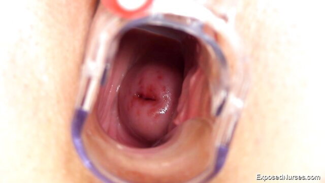 Belle Claire's closeup vagina speculum exam in nurse porn
