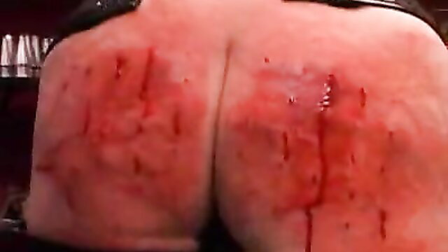 Lady with big bleeding bottom in insane torturing pain