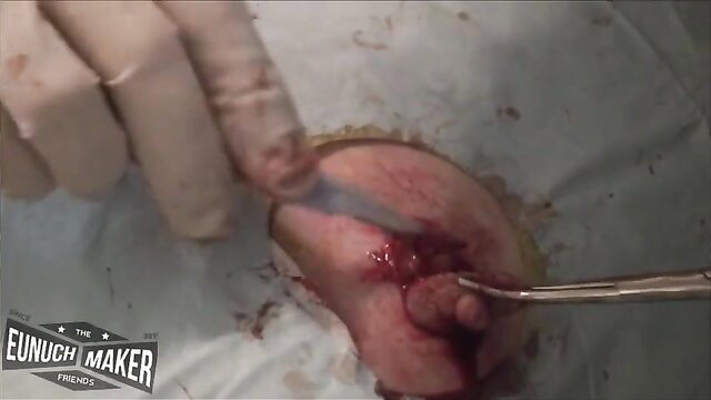 Extreme closeup of bloody penis castration surgery in eunuch maker video