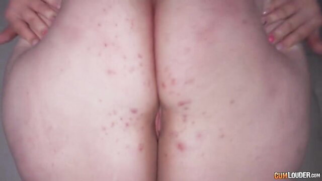 Shameless BBW mommy's big pale ass and pussy closeup with red spots