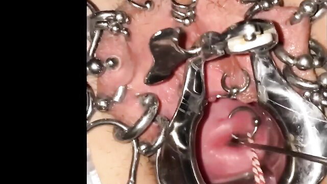 Extreme closeup of cervix sounding with speculum and piercings