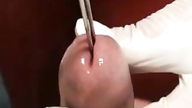 Closeup of gloved hand inserting urethral sounding rod into erect penis