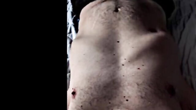 Man's emaciated back with vore digestion wounds, belly acid fetish