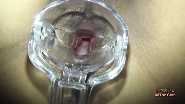 Amateur Japanese girl speculum exam closeup pussy view
