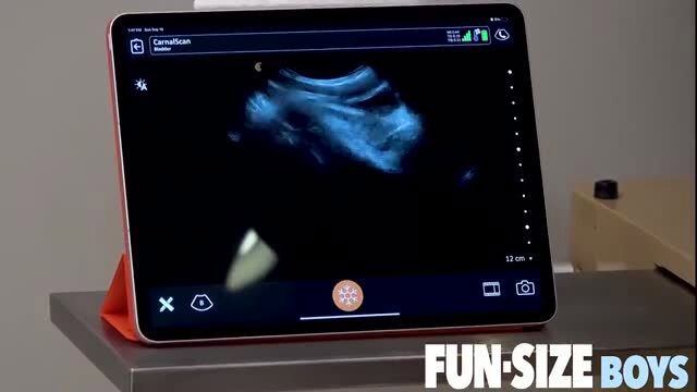 Dallas Steele's CarnalScan ultrasound shows massive cock on iPad, Fun Size Boys